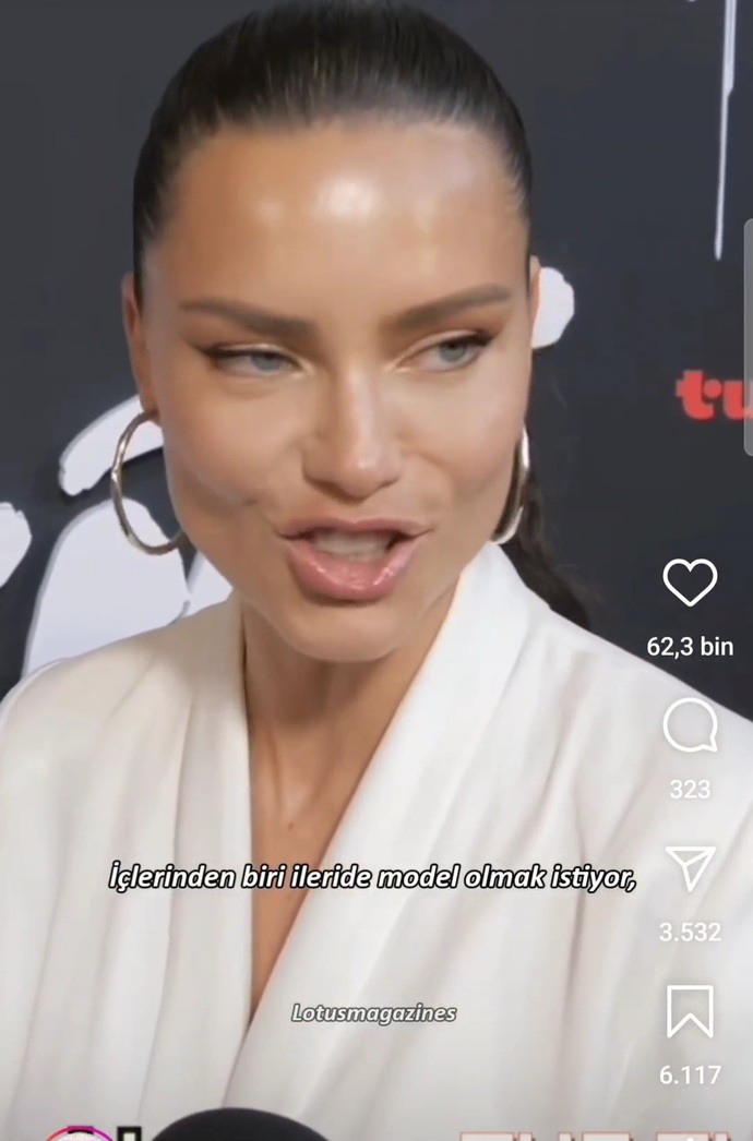 Koskoca Adriana Lima botoks yapmış, yaşlanınca hepimizin kaderi botoks mu?