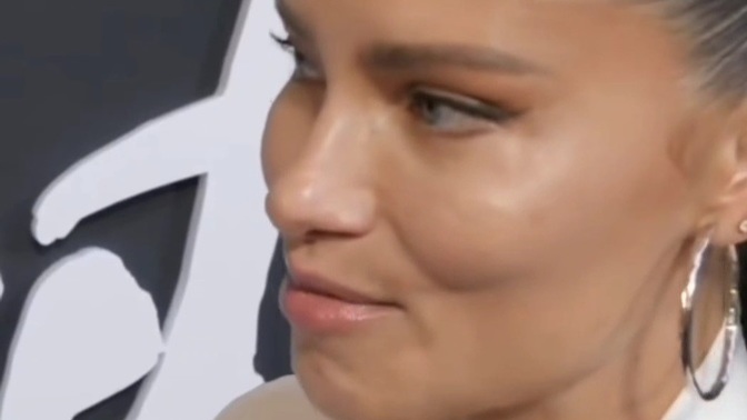 Koskoca Adriana Lima botoks yapmış, yaşlanınca hepimizin kaderi botoks mu?