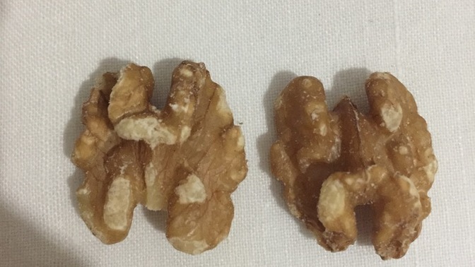 Hangisini yesem sağdakini mi soldakini mi?