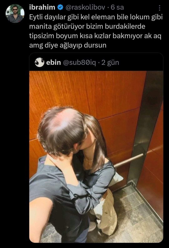 Erkekte kelliği sorun eder misiniz?