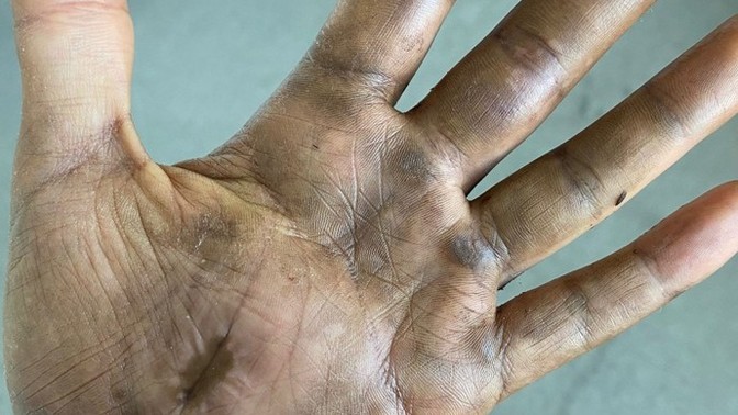 Elim ezildi sağlıkçı var mı?