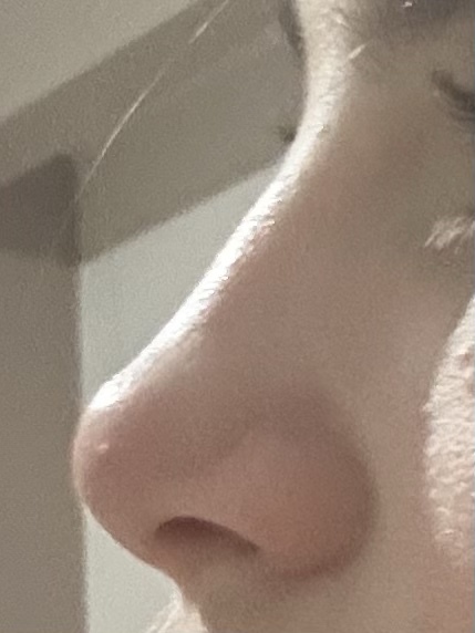 Hangi burun şekli daha güzel sizce?