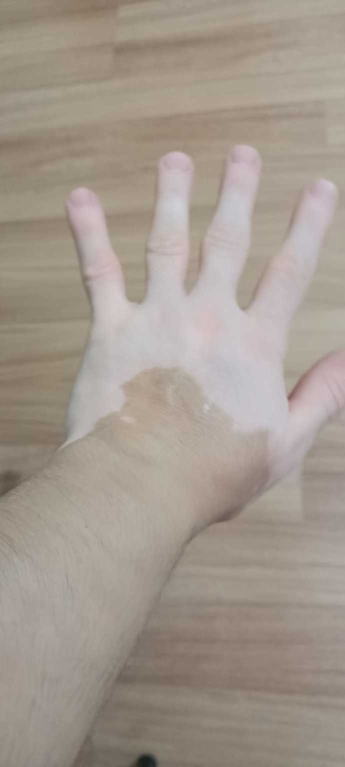 Sizce Kız Beni Bu Şekilde Kabul Edermi?