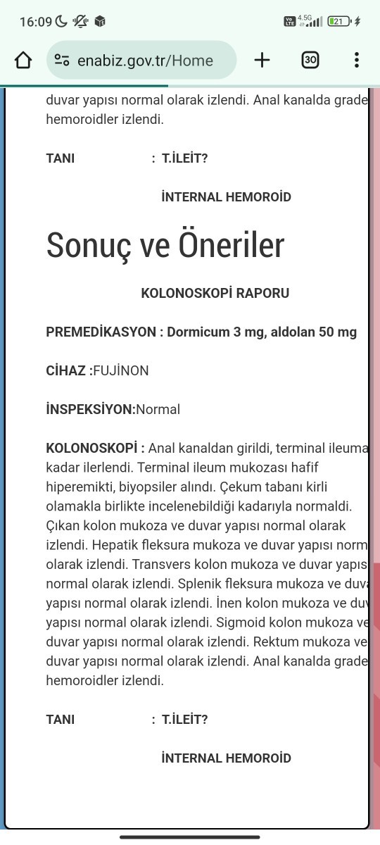 Arkadaşlar acaba kansermi oldum bana dediki ödem var ödem kanser olabilirmi biyopsi yaptı?
