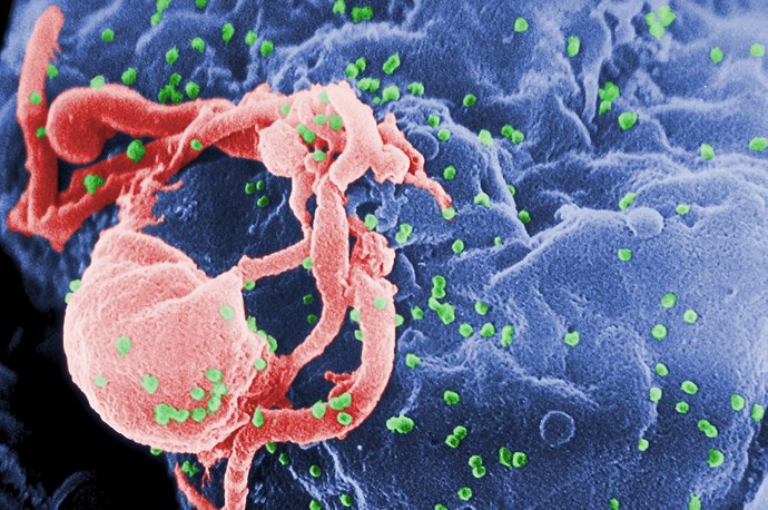 Evlenmeden önce HIV pozitif olduğunu saklayan kocası hakkında kasten öldürmeye teşebbüs davası açıldı. Ceza almalı mı sizce?