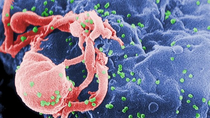 Evlenmeden önce HIV pozitif olduğunu saklayan kocası hakkında "kasten öldürmeye teşebbüs" davası açıldı. Ceza almalı mı sizce?