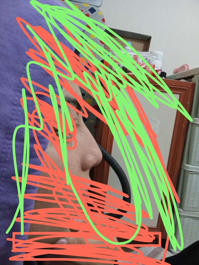 Burnum nasıl hafifte olsa kemeri var mı?