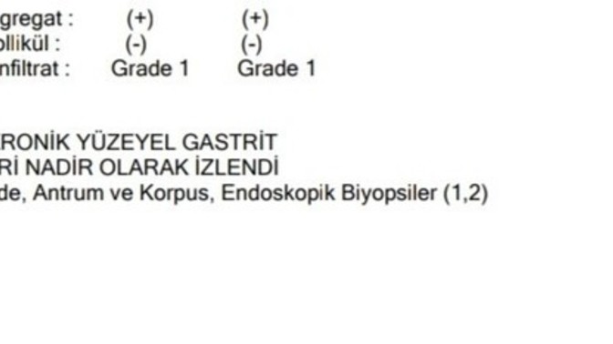 Grade 1 ne demek yaaa mide kanserinin birinci evresindemiyim😭?