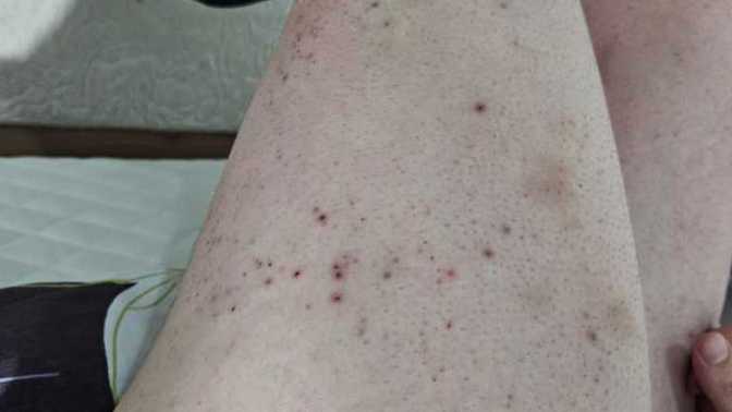 Yaklaşık 1 aydır böyle kaşıntı çok arttı ve şu an böyle ne kullanmalıyım?