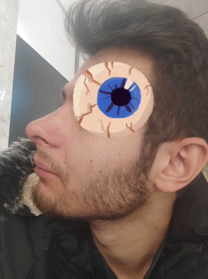 Ameliyatın 1 ayı dolmadi ama bana iyi gelmiyor?