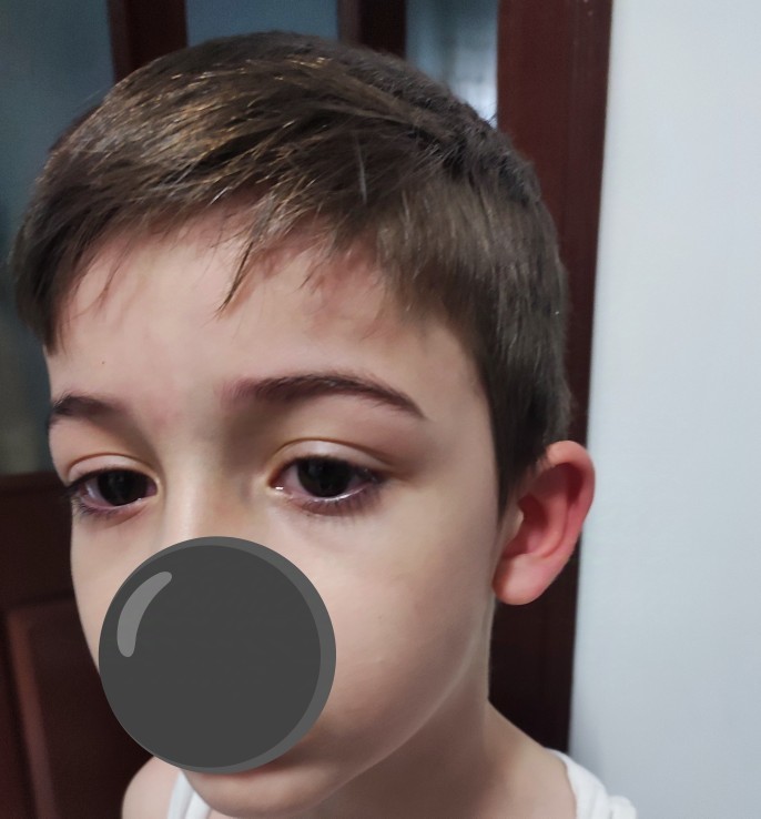 Kardeşimin öğretmeni kulaklarını çekip kıpkırmızı yapmış, öğretmenlikten attırabilir miyim?