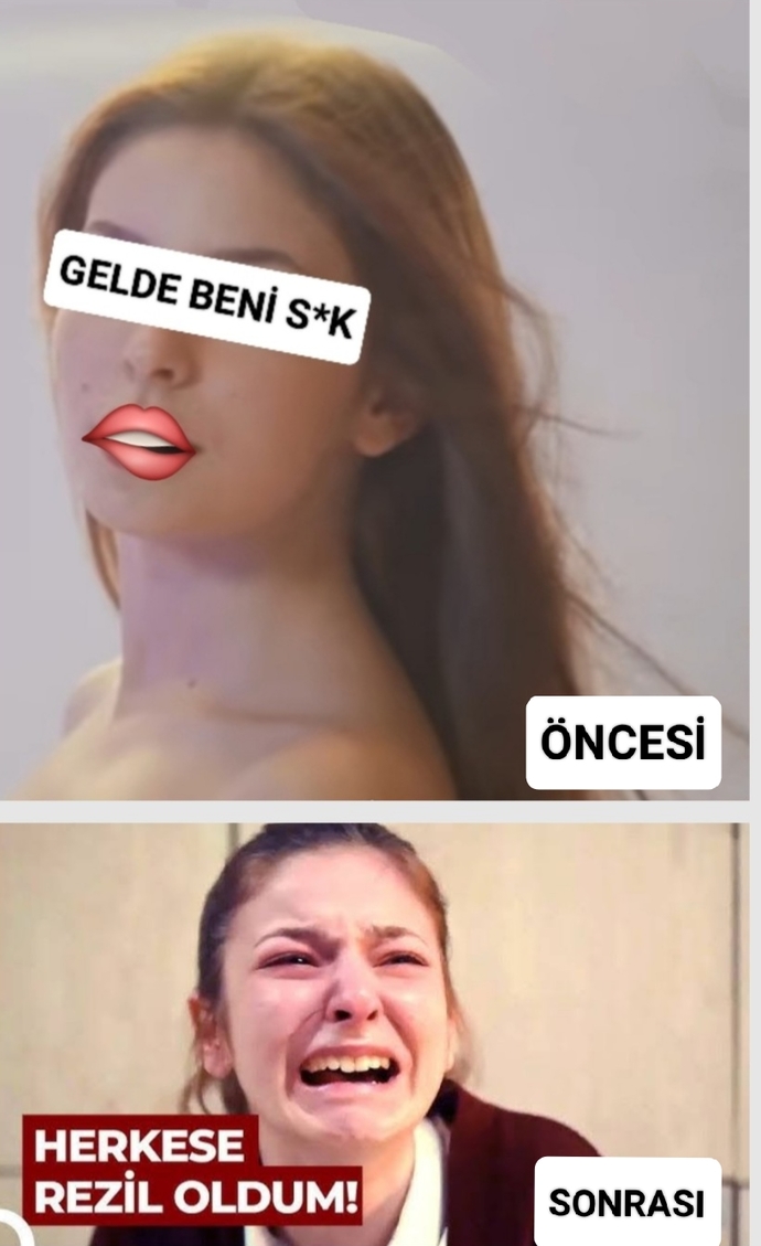 Beyni yanmışın milleti denir.