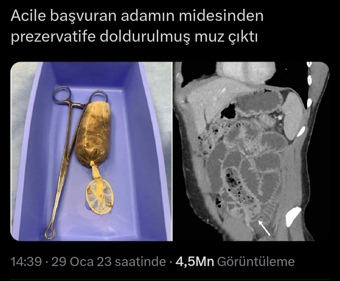 Hadi bu da kaçakçılığa ne kadar hakim olduğumuzun turnusolu olsun 😂😂