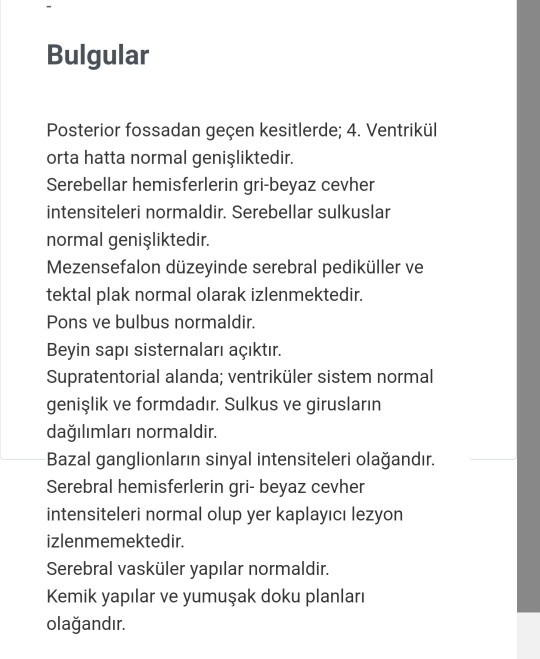 Beyin mr sonuçlarım anlayan var mi?