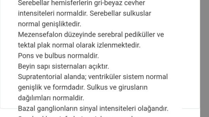 Beyin mr sonuçlarım anlayan var mi?