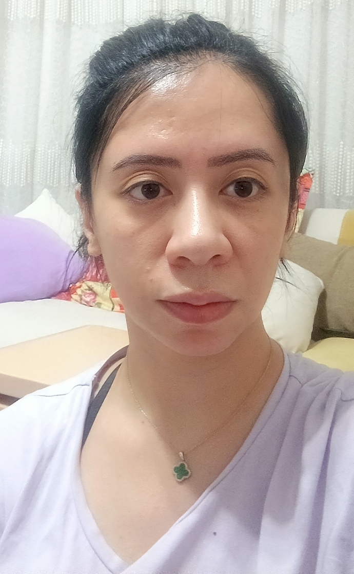 ÇÇok yakın çekim kusura bakmayın, bu çizgilerden nefret ediyorum yaşlandıgım için mi sizde de var mı 🥴😮‍💨?
