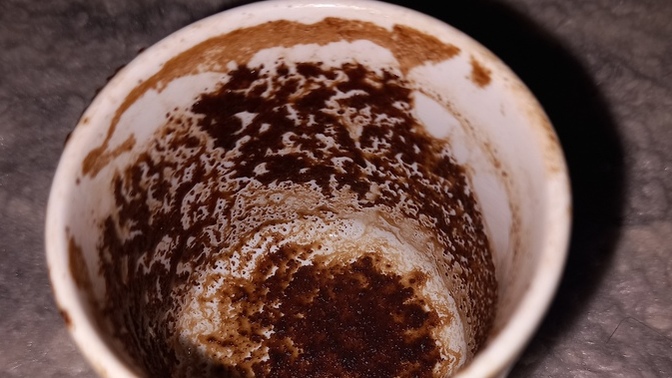 Falima bakar misiniz nolur sevinirim 🥲?