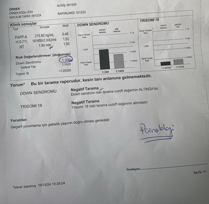 Dowm sendrom var mı?