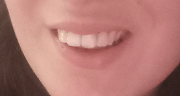 Bu dişler nasıl size göre?