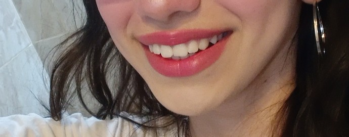 Smiley piercing istiyorum ama dişlerim hoşuma gitmiyor. Yakışır mı?