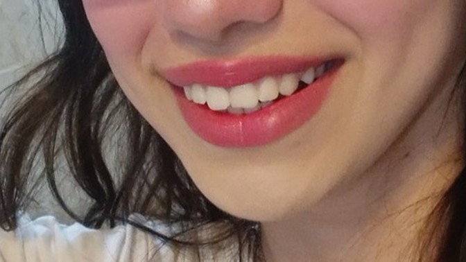 Smiley piercing istiyorum ama dişlerim hoşuma gitmiyor. Yakışır mı?