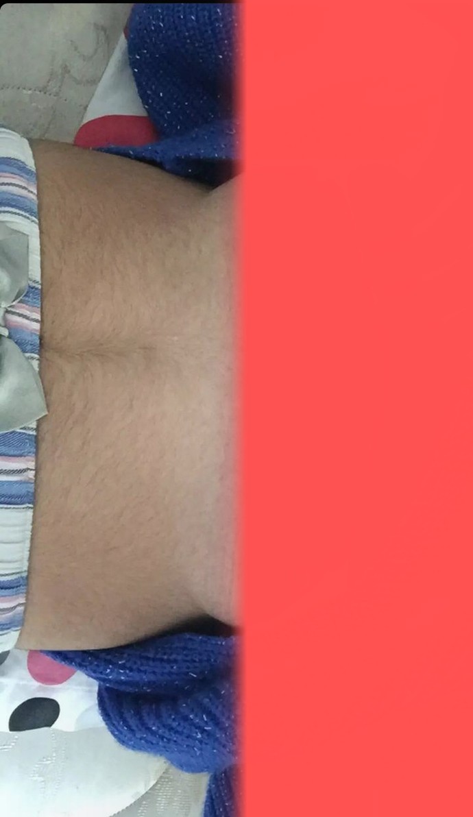 Çok mu kıl var vücudumda? Ve nasıl giderebilirim?