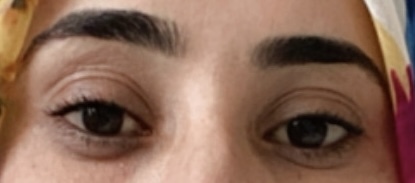 Kipriklerimi doğal yoldan uzatırım ✨?