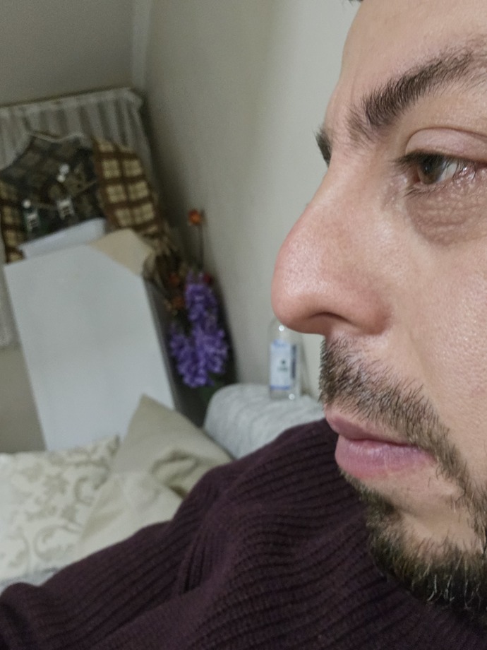 Bu burnun estetiğe ihtiyacı var mı?