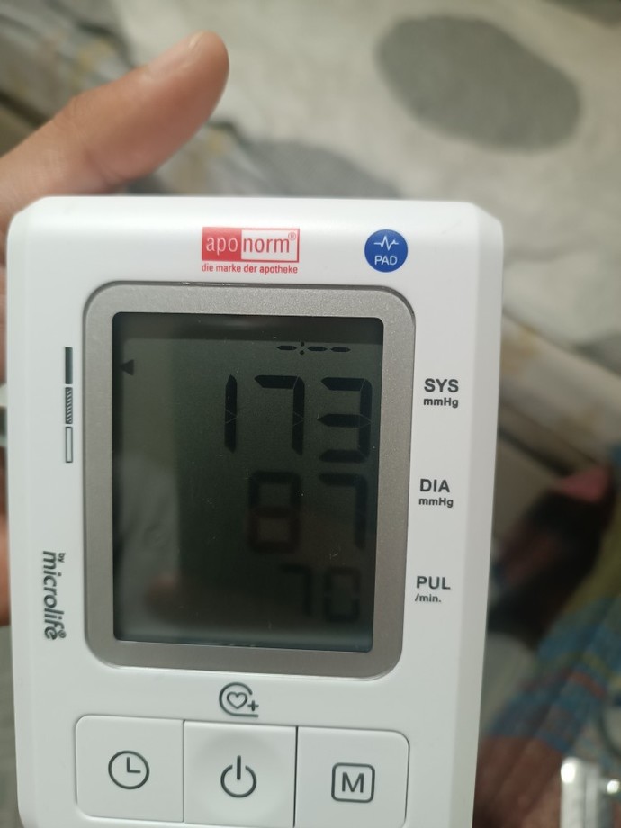Doktor var mı tansiyonum çok yüksek degilmi?