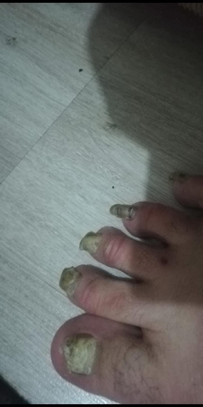 Tırnaklarımı neyle kesebilirim?