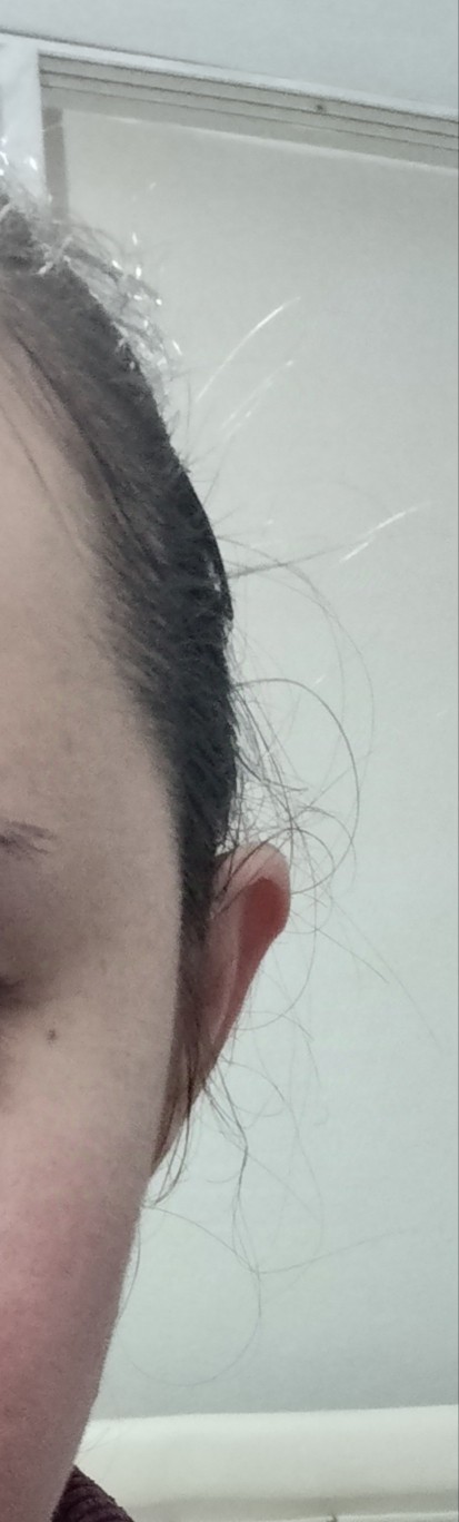 Kulaklarımın şekli çok mu kötü?