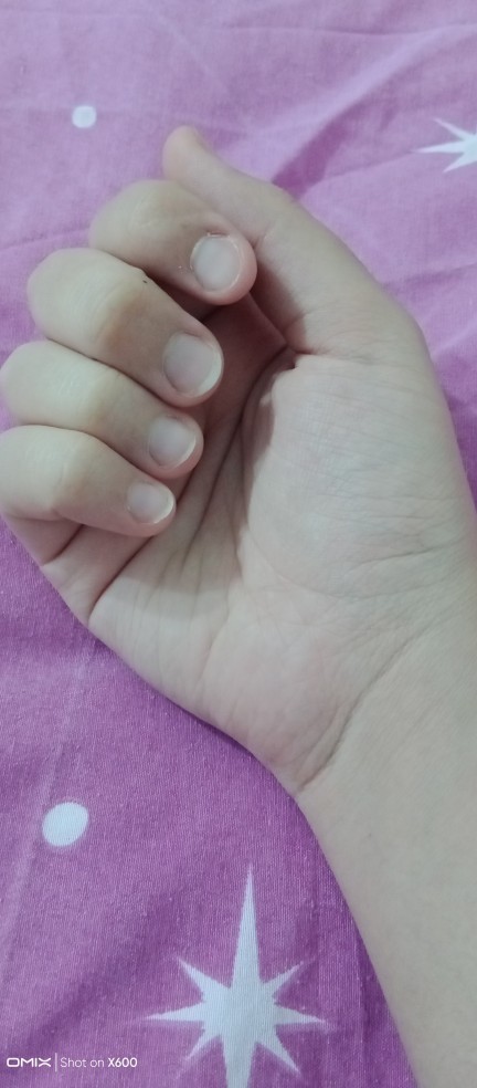 Tırnağım için ne yapabilirim?
