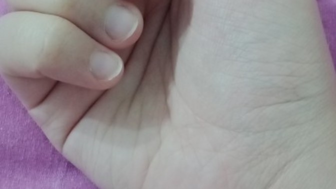 Tırnağım için ne yapabilirim?