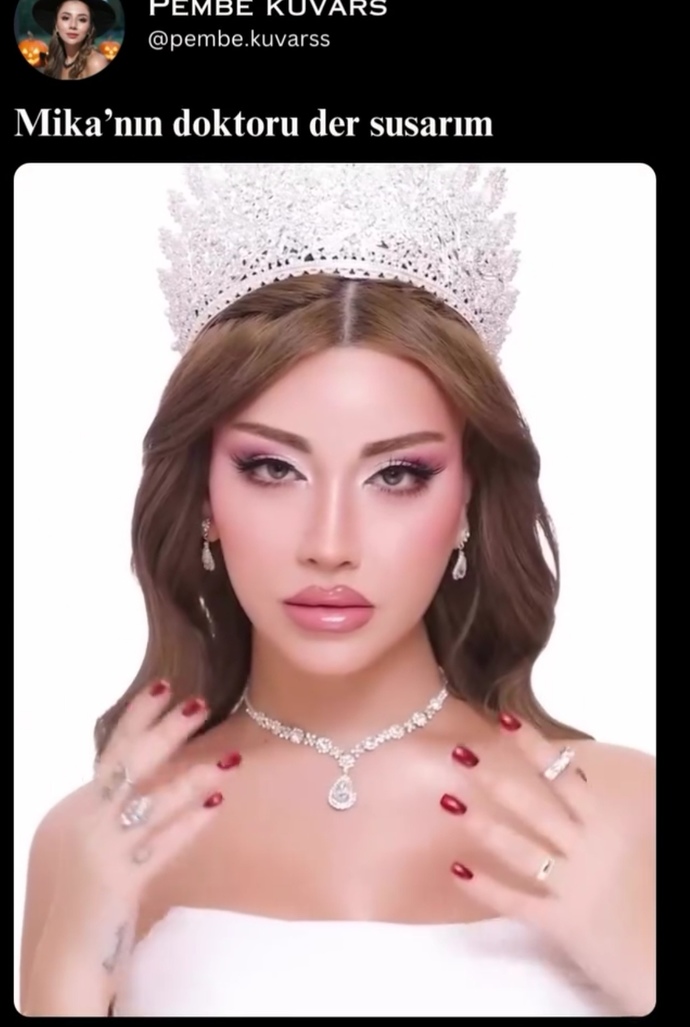 Beyler mikaya düştüğünüz oluyor mu? Doğru söyleyin?