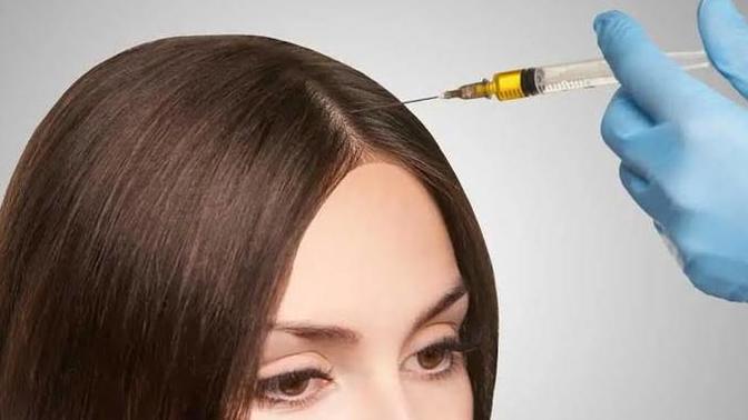 Prp saç tedavisi yaptırmak ister miydiniz?