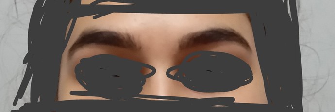 Kaşlarımdan dolayı dışarı bile çıkasım gelmiyor ne yapmalıyım?