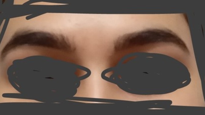 Kaşlarımdan dolayı dışarı bile çıkasım gelmiyor ne yapmalıyım?
