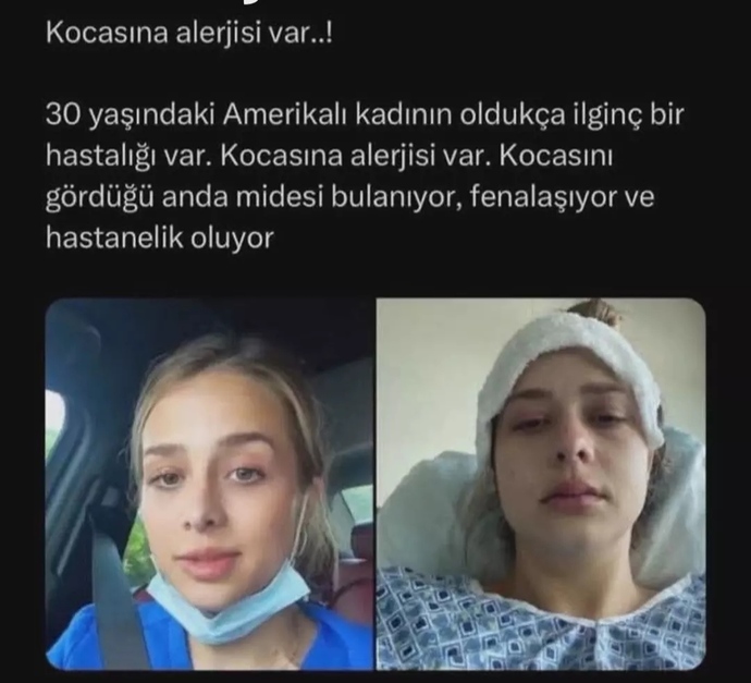 Kadın erkek cinsinin neden birbirlerine karşı tahammülü yok?