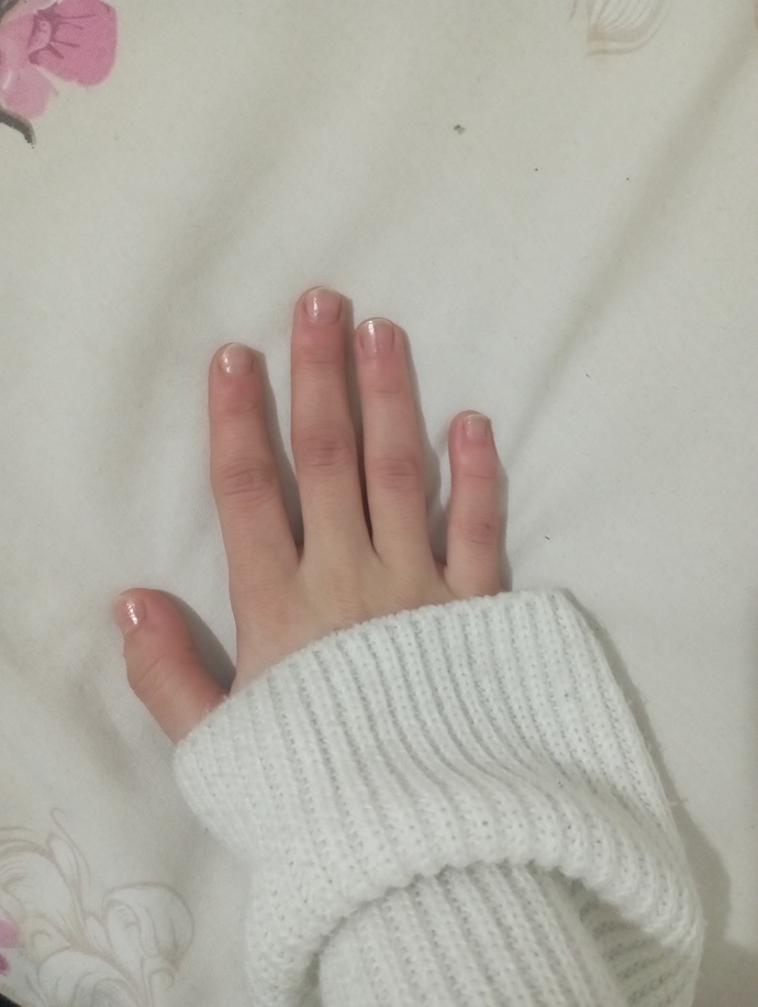 Ellerim çocuk eli gibi ne yapmam lazım?