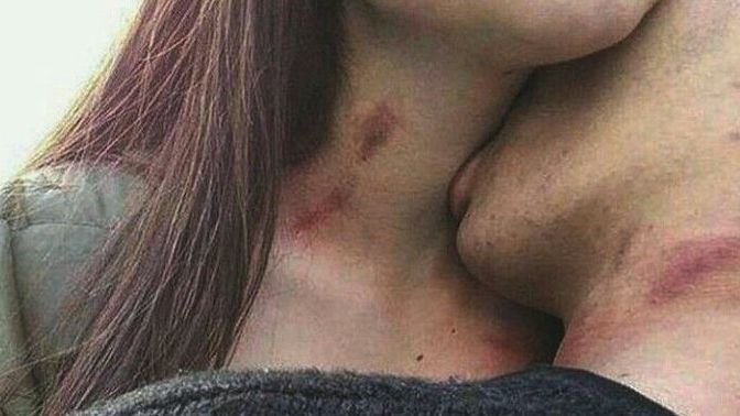 Sevişirken iz bırakmak, amatörlüğün mü yoksa fazla tutkunun mu göstergesidir?