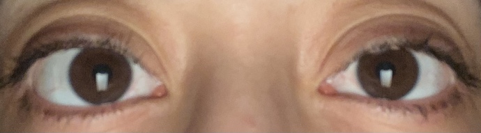 Bir gözüm diğerinden daha büyük arka kamerada özellikle veya fotoğrafı ters çevirince?