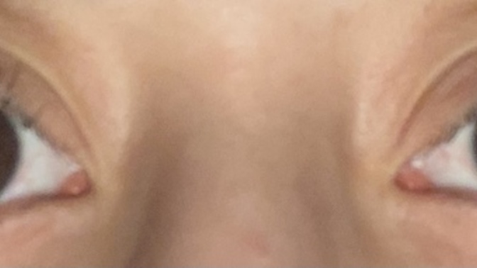 Bir gözüm diğerinden daha büyük arka kamerada özellikle veya fotoğrafı ters çevirince?
