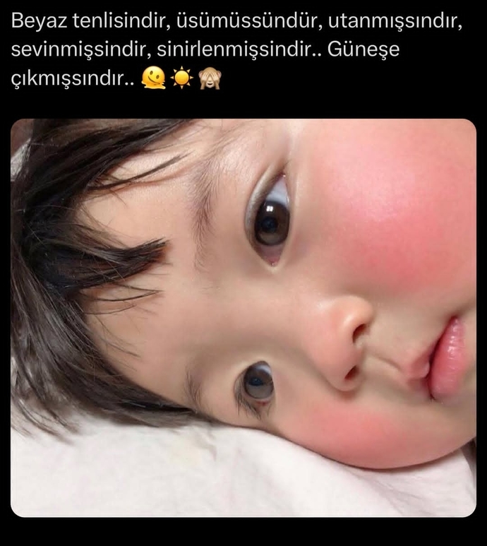 Beyaz tenliler burada mı? ?