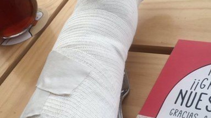 Hiç kolunuz veya bacağıniz kırıldı mı?