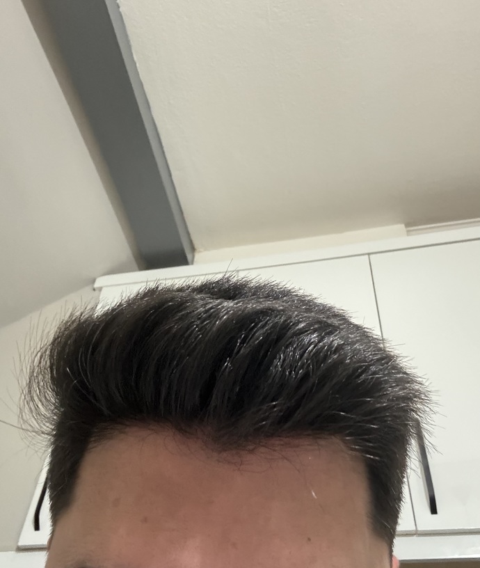 Sizce saçlarım seyrek mi kellik problemi yaşar mıyım?