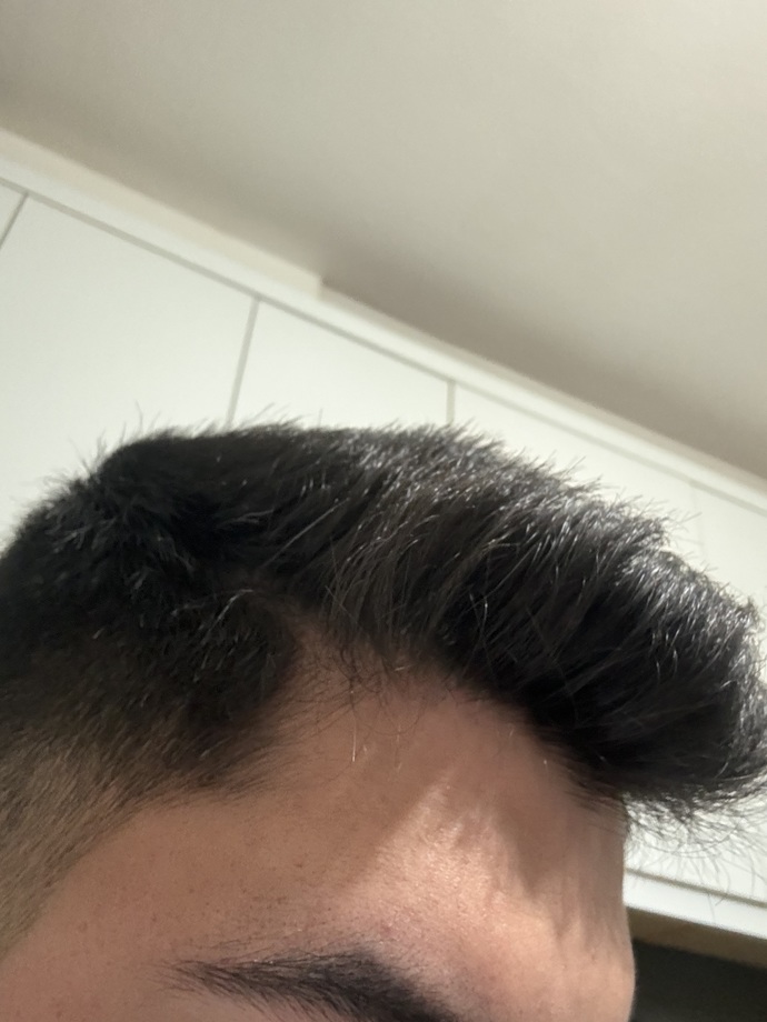 Sizce saçlarım seyrek mi kellik problemi yaşar mıyım?
