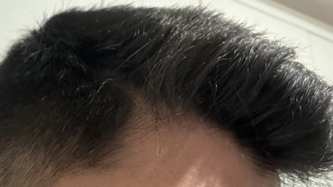 Sizce saçlarım seyrek mi kellik problemi yaşar mıyım?