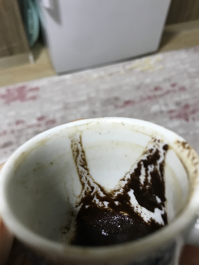 Falımda ne görüyorsunuz anlatır mısınız lütfen?