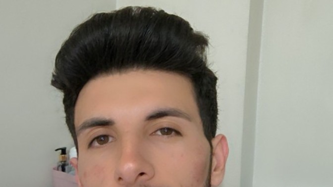 Ağda sonrası kızarıklık?