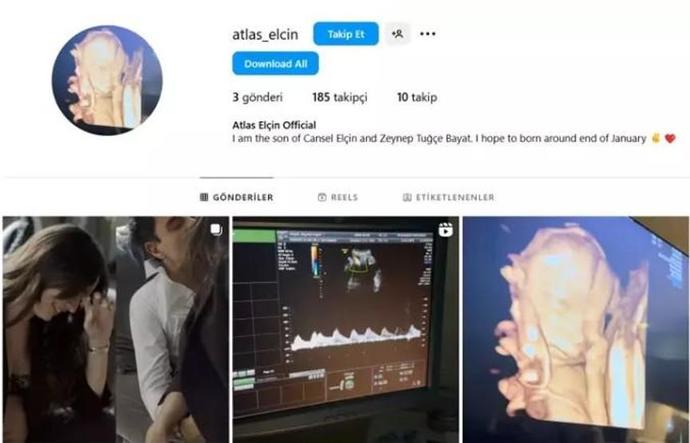 Zeynep Tuğçe Bayat çifti bebekleri için sosyal medya hesabı açtı! Normal mi?